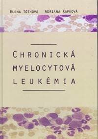 Chronická myelocytová leukémia - Kafková, Elena Tóthová Adriana 1