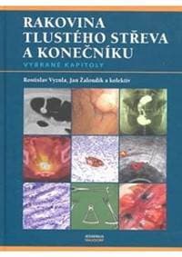 Rakovina tlustého střeva a konečníku - vybrané kapitoly - Vyzula, Žaloudík a kolektiv Jan, Rostislav