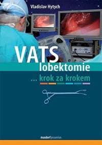 VATS lobektomie krok za krokem - Hytych Vladislav 1