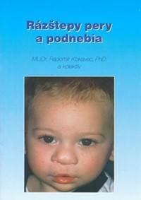 Rázštepy pery a podnebia - Radomír Kokavec 1