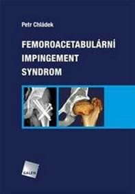 Femoroacetabulární impingement syndrom - Petr Chládek 1
