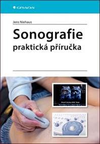 Sonografie - praktická příručka - Niehaus Jens