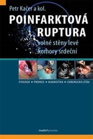 Poinfarktová ruptura - autor neuvedený