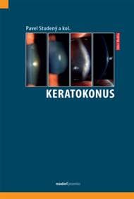 Keratokonus - Pavel Studený 1