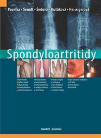Spondyloartritidy - Pavelka Karel a kolektiv