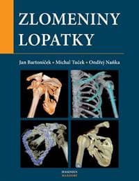 Zlomeniny lopatky - Kolektív 1