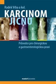Karcinom jícnu - Průvodce pro chirurgickou a gastroenterologickou praxi - Vrba Radek 1