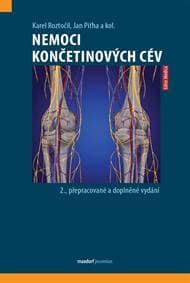 Nemoci končetinových cév - Roztočil, Jan Piťha Karel 1