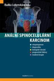 Anální spinocelulární karcinom - Lohynská Radka