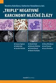 „Triple“ negativní karcinomy mléčné žláz - Kolečková, Katherine Vomáčková Markéta