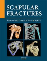 Scapular fractures - Jan Bartoníček, Christopher Colton, Michal Tuček 1