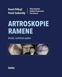 Artroskopie ramene - Kolektív 1