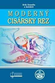 Moderný cisársky rez + CD - Erik Dosedla 1