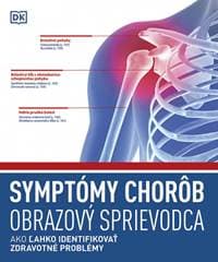 Symptómy chorôb. Obrazový sprievodca - autor neuvedený 1