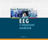 EEG v intenzivní medicíně - Doležalová a kol. Irena