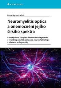 Neuromyelitis optica a poruchy jejího šišího spektra - Petra Nytrová