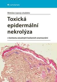 Toxická epidermální nekrolýza v kontextu závažných bulózních onemocnění - Lipový Břetislav