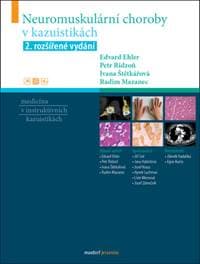 Neuromuskulární choroby v kazuistikách - Edvard Ehler, Ivana Štětkářová, Petr Ridzoň, Radim Mazanec
