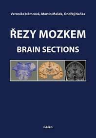 Řezy mozkem - Veronika Němcová, Martin Mašek, Ondřej Naňka
