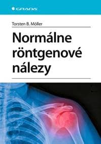 Normálne röntgenové nálezy - autor neuvedený 1