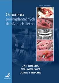 Ochorenia periimplantačných tkanív a ich liečba - Ján Kučera, Eva Kovaľová 1
